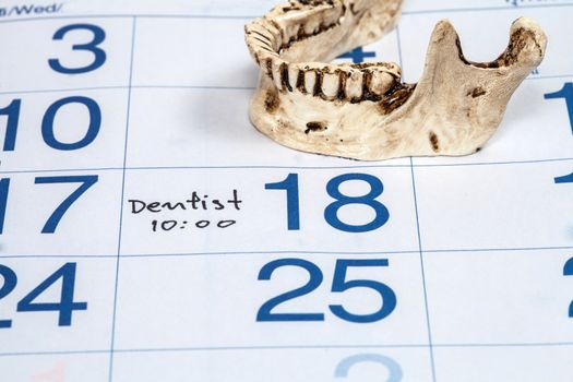 Reminder on calender for Dentist Appointment