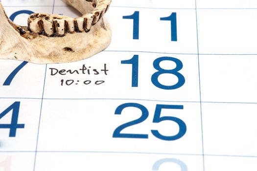 Reminder on calender for Dentist Appointment