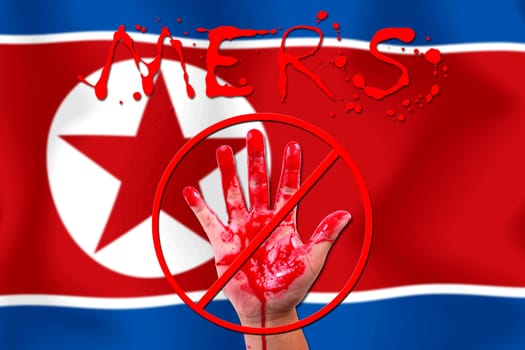 Concept show hand stop MERS Virus epidemic  North Korea flag background.