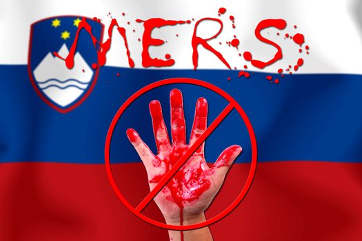 Concept show hand stop MERS Virus epidemic  Slovenia flag background.