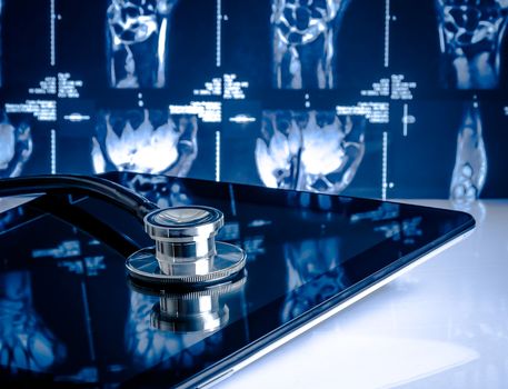 medical stethoscope on modern digital tablet in laboratory on x-ray images background. Concept of health care with new technology