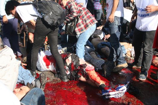 TURKEY, Ankara : People try to help wounded victims of a terror attack which killed at least 30 people in Ankara, capital city of Turkey on October 10th, 2015. Twin explosions outside Ankara's main train station on the morning appear to have targeted hundreds of people who had gathered to protest violence between authorities and Kurdish separatist group, the PKK.