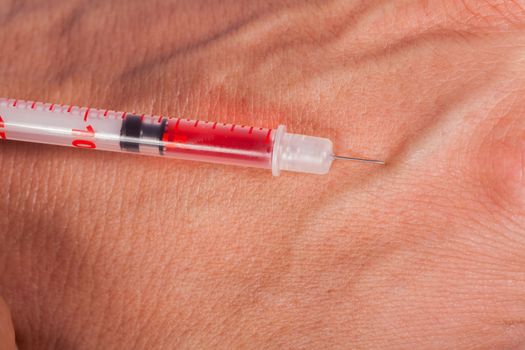 Subcutaneous medical injection concept with a small hypodermic syringe filled with a red liquid penetrating the skin and producing a flow of dripping blood in a close up view