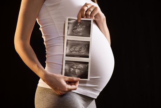Pregnant woman on black background holding her child's ultrasound picture. 