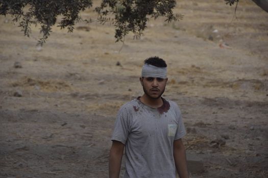 SYRIA, Harasta: This picture shows an injured man in the the Syrian town of Harasta on October 23, 2015 following a series of recent airstrikes. The Syrian army launched an offensive in the area which targeted various rebel opposition. In addition to airstrikes, the Syrian army also launched a ground operation in the region.