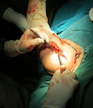 Orthopedic doctors performing a surgery on the injured arm of a patient.                               
