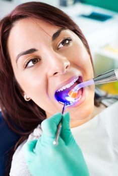 Dentist with dental curing UV lamp finishing repair tooth on the female patient in the office.