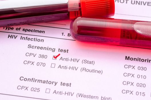 Sample blood collection tube with HIV test label on HIV infection screening test form.