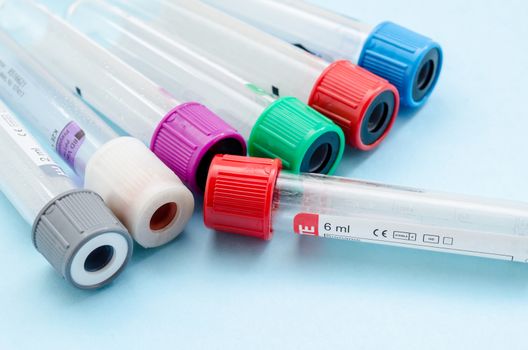 Blood sample test and empty tube blood for blood test screening with blank label for your text in laboratory.