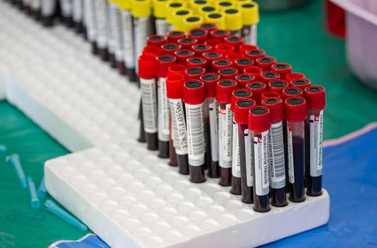 arranges test tubes with blood on a tray