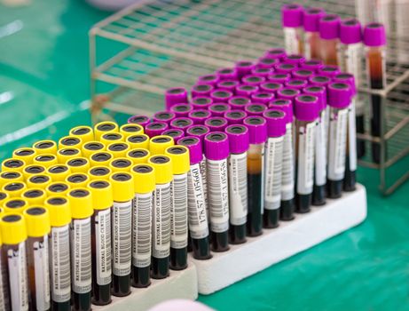 arranges test tubes with blood on a tray