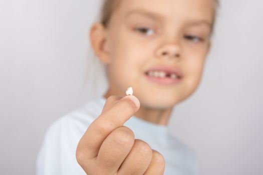 Six year old girl showing her fallen Milk front upper teeth