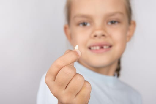 Six year old girl showing her fallen Milk front upper teeth