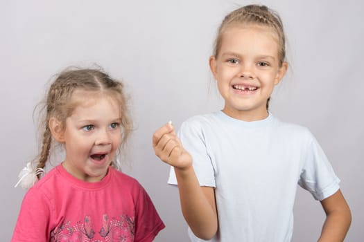 Six year old girl showing her the other girl had fallen Milk front upper teeth