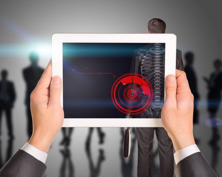 Businessman holding tablet with x-ray of man