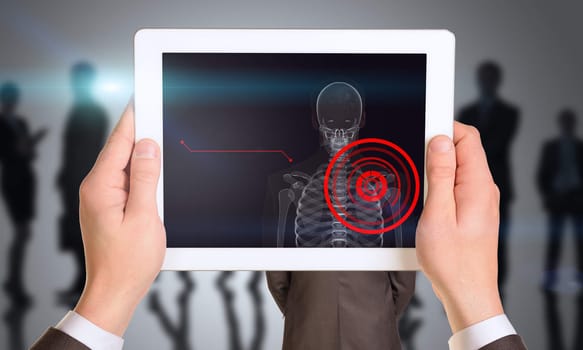 Businessman holding tablet with x-ray of man