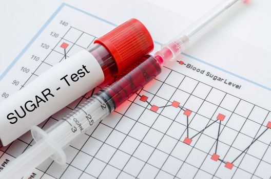 Sample blood for screening diabetic test in blood tube on blood sugar control chart.