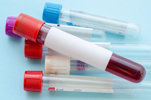Blood sample test and empty tube blood for blood test screening with blank label for your text in laboratory.