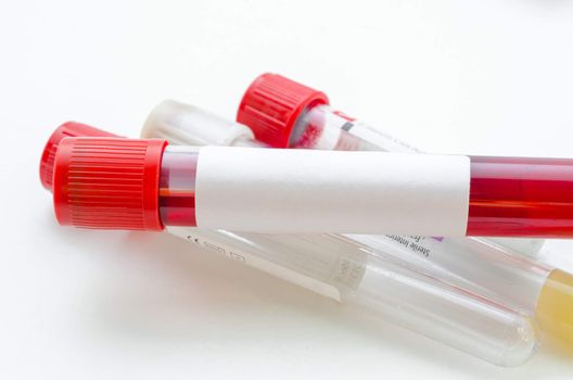 Blood sample test and empty tube blood for blood test screening with blank label for you text on white background.