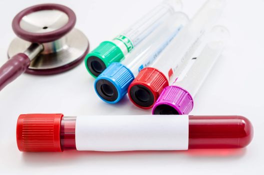 vacuum tubes for collecting and blood samples with blank label and stethoscope for screening test on white background.