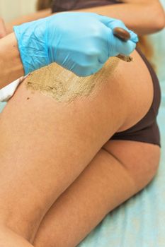 procedure for women hip against cellulite and fat