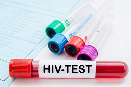 Blood sample for HIV test and empty tube blood for blood test screening with blank label on request form screening test.