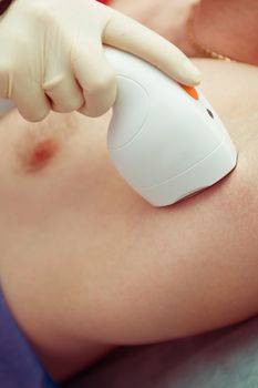 man receiving laser epilation at armpit on beauty center