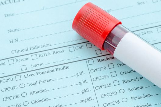 Blood tube for test with blank label and blood in syringe on request form laboratory