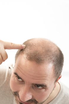 40s man with an incipient baldness , close-up, white background