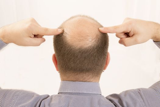 40s man with an incipient baldness , close-up, white background