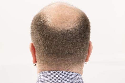40s man with an incipient baldness , close-up, white background