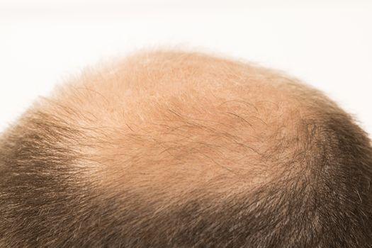 40s man with an incipient baldness , close-up, white background