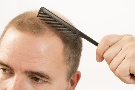 40s man with an incipient baldness doing hair with background