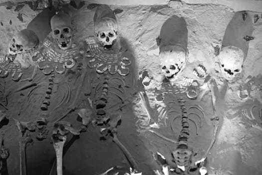 Skull and other human bones in dark tones