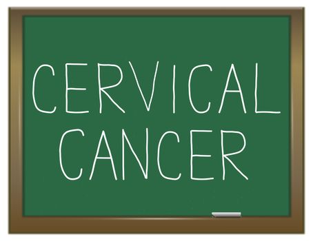 Illustration depicting a green chalkboard with a cervical cancer concept.