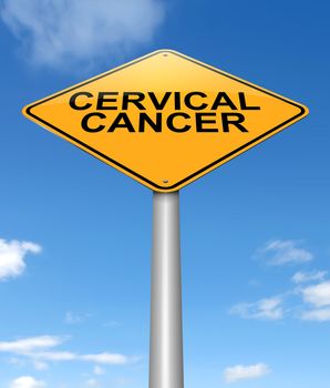 Illustration depicting a sign with a cervical cancer concept.