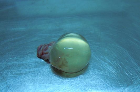 Large follicular cyst, which was formed by the bride cat in heat, which was given hormonal medications. Material after ovariectomy.