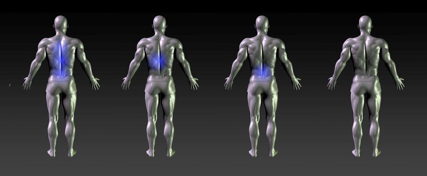 Spine Recovery or Rehabilitation with Blue Glow