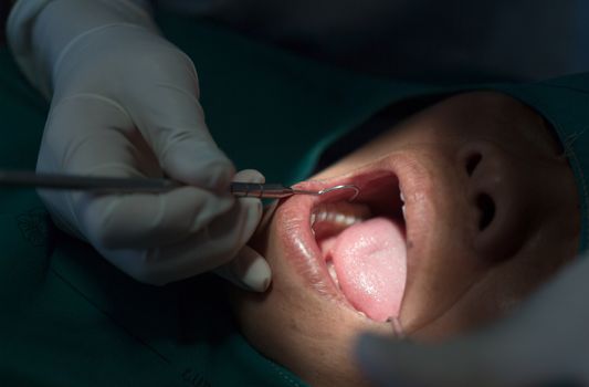 Dentist examining a patients teeth in the dentists chair under bright light at the dental clinic