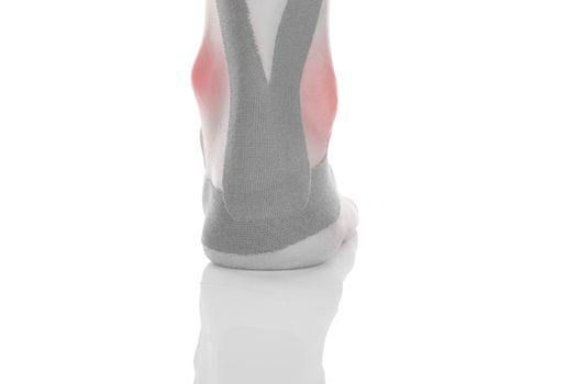 Kinesio tape on female heel isolated on white background. Chronic pain, alternative medicine. Rehabilitation and physiotherapy.