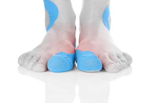 Kinesio tape on female foot isolated on white background. Chronic pain, alternative medicine. Rehabilitation and physiotherapy.