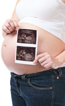 Pregnant young woman showing ultrasound pisture of her baby