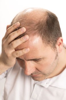 Baldness Alopecia man hair loss haircare medicine bald treatment transplantation