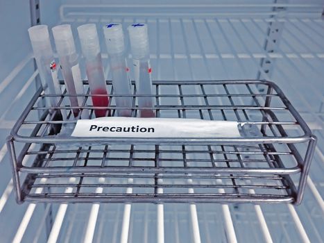Sample blood collection tube with precaution label on rack after analysis HIV infection screening test in refrigerator at laboratory hospital