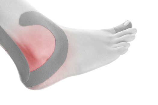 Therapeutic tape on female ankle isolated on white background. Chronic pain, alternative medicine. Rehabilitation and physiotherapy.