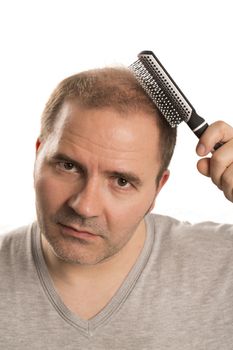 Baldness Alopecia man hair loss haircare medicine bald treatment transplantation