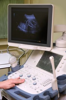 medical examining pregnant belly by ultrasonic scan of a baby on a screen