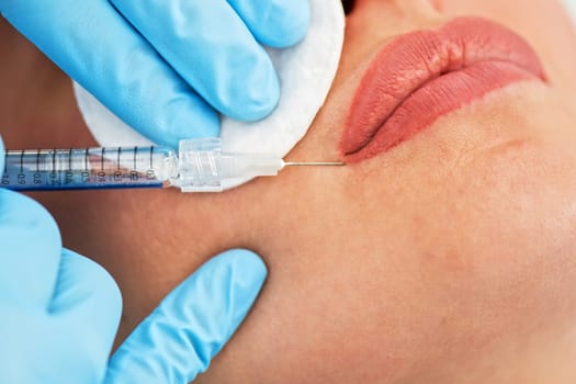 Closeup of woman gets injection in her lips