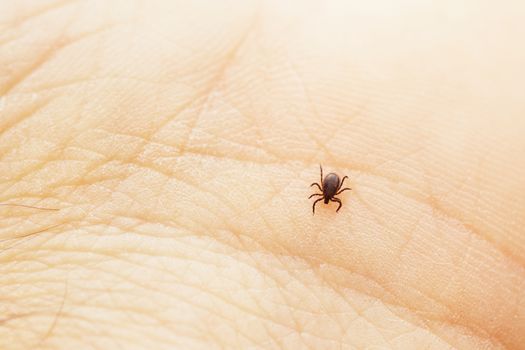 Tick is crawling on the human palm