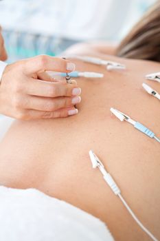 Doctor applying electroacupuncture on a patient's back